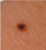 skin care in Boston area